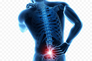 Back Pain HQ Image Free PNG