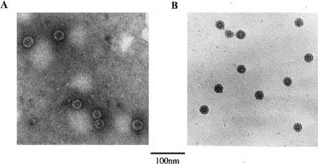 Electron Micrograph Of Hbc Particles A Fme1 - Hbc Monochrome Png