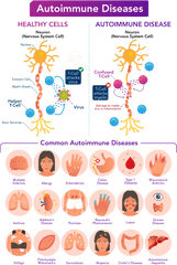 The Immune Response A Cellular War Letu0027s Talk Science - Autoimmune Disease Illustration Png