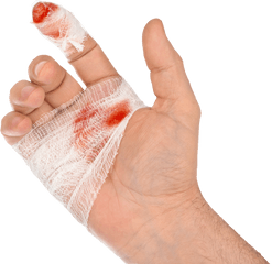 Download Steel Doctor Blade Injury Cut - Hand Injury Photos Download Png