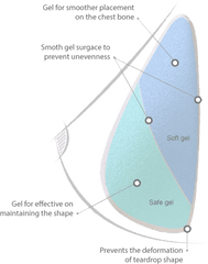 Download Hd The 3rd Generation Implant Dual Chamber Teardrop - Small Teardrop Implant Dual Chamber Png