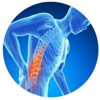 Back Pain Picture Free Photo PNG
