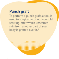 Bidding Your Old Scars Goodbye - Circle Png