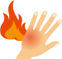 Skin Clipart Burned Food - Burn Clipart Png