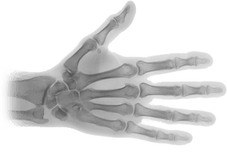 Download Hd X Ray Transparent Png - X Ray Hand Png