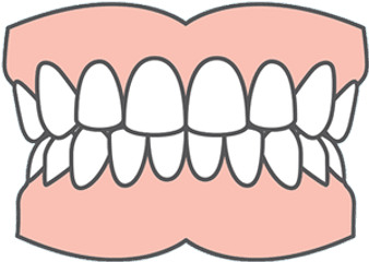 Partial Dentures - Dental Implant Icon Png