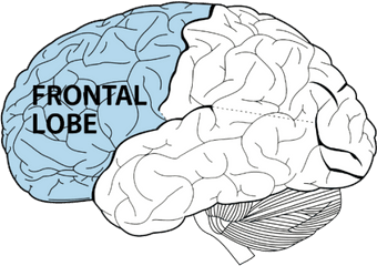 Adhd The Brain - Part Of The Brain Does Adhd Affect Png